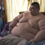 Fat treatments rise.